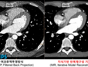 필립스, 31일 ‘필립스 CT 이노베이션 심포지움’ 개최
