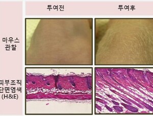 메디포스트, 산자부 ‘줄기세포 발모제’ 연구기관 선정