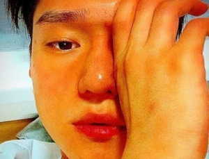 고경표, 뇌수막염 입원 중 “윤계상님도 쾌차하길”