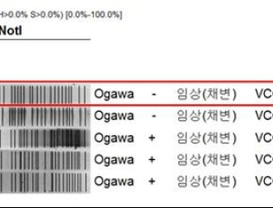 “네 번째 콜레라 환자 유전자지문 다르다”
