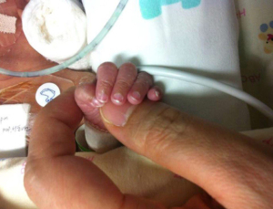 [기획] ‘병원비 걱정 없는 나라’…이른둥이 가족에게도 해당될까?
