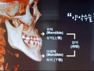 양악수술의 의학적 필요기준은 어디까지일까