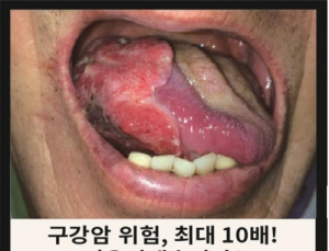 청소년 흡연율 증가에 ‘민무늬 담뱃갑’ 제도 국내에도 도입 추진