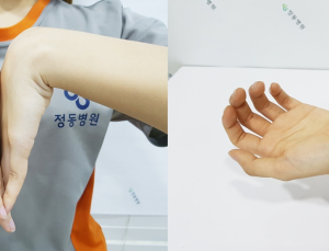 [정동리포트] 과도한 폰질 손저림 유발 손목터널증후군 자초한다