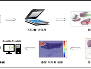 국내 최초 AI 기반 전립선암 진단 소프트웨어 'DeepDx-Prostate' 허가
