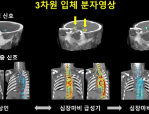 ‘화 낸 후 심장마비 발생' 기전, 세계 최초로 3차원 입체분자영상 통해 밝혀