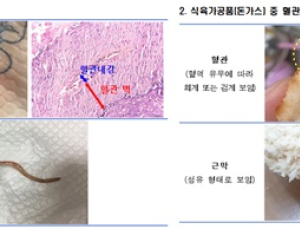 고기·돈까스 등서 이물질?…혈관-근막은 섭취해도 안심 
