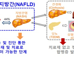 '비알코올성 지방간' 심하면 10년 내 심혈관계질환 위험 4~5배 ↑