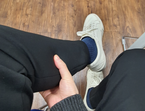 ‘하지정맥류’ 진단과 치료법, 제대로 알자