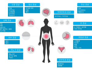 코로나19 진단 4주 후 ‘복합증상’ 나타나 