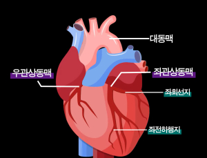 좁아진 관상동맥, 새 혈관길 내서 치료한다