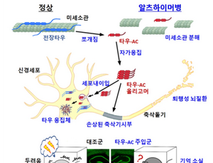 ‘타우 단백질’ 치매 발병 기전 알아냈다… 치료제 개발 가능성 제시