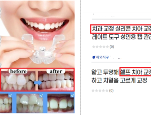 “집에서 셀프 치아교정 가능”… 거짓 광고 적발