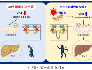 “노화로 인한 지방간, ‘이것’으로 예방”