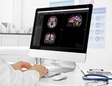 건국대병원, ‘뉴로핏 아쿠아’ 도입…AI 분석 뇌 MRI 맞춤형 진료 본격화