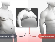 근육 늘리는 ‘비만신약’ 나오나…한미약품, 美 FDA 임상 1상 신청