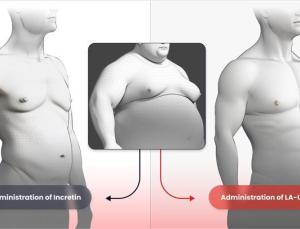 근육 늘리는 ‘비만신약’ 나오나…한미약품, 美 FDA 임상 1상 신청