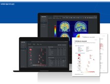 ‘주사 대신 AI’…건국대병원, 알츠하이머 진단 솔루션 BTX BRAIN 도입