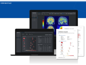 ‘주사 대신 AI’…건국대병원, 알츠하이머 진단 솔루션 BTX BRAIN 도입