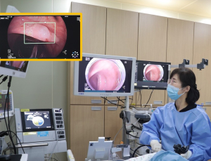 ‘놓치는 선종 줄였다’…AI 활용 대장내시경, 검사 품질 향상 입증