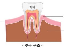 잇몸 통증 계속된다면? 복용약도 체크해야