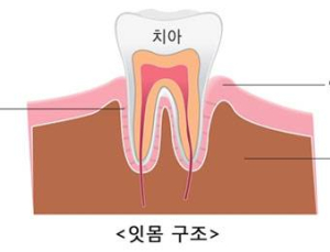 잇몸 통증 계속된다면? 복용약도 체크해야